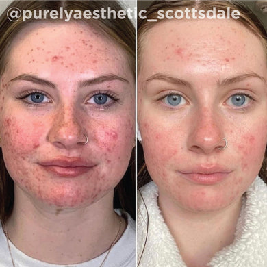 Real Before After 1