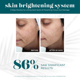 Skin Brightening System