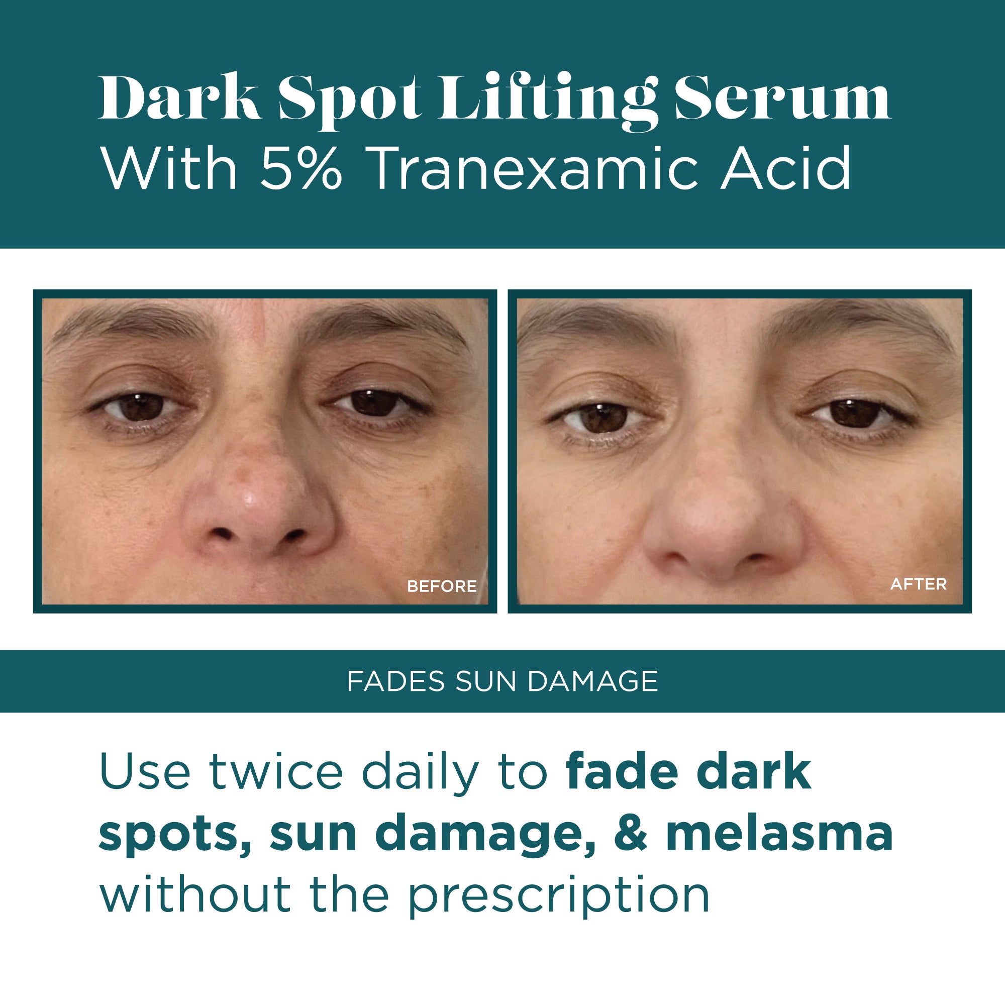 Dark Spot Lifting Serum with 5 Tranexamic Acid VI Derm